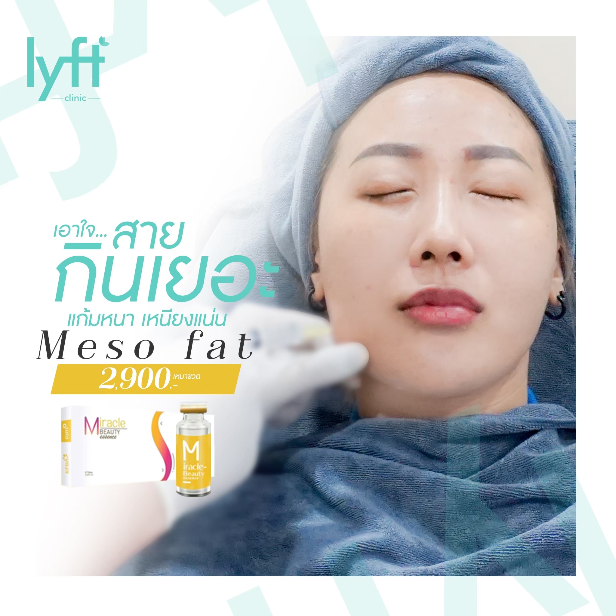 เมโสแฟต (Meso Fat)
